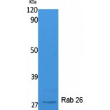 RAB26 Antibody - Western blot of Rab 26 antibody