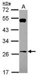 RAB26 Antibody - Sample (30 ug of whole cell lysate) A: U87-MG 12% SDS PAGE RAB26 antibody diluted at 1:1000