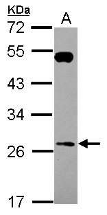 RAB26 Antibody - Sample (30 ug of whole cell lysate) A: U87-MG 12% SDS PAGE RAB26 antibody diluted at 1:1000