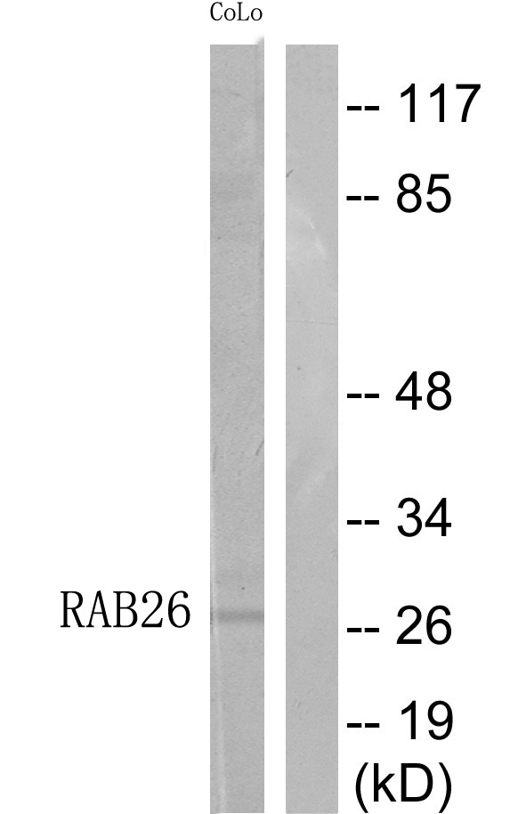 RAB26 Antibody - Western blot of extracts from COLO cells, using RAB26 antibody.