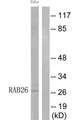 RAB26 Antibody - Western blot of extracts from COLO cells, using RAB26 antibody.