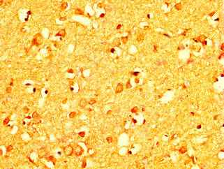 RAB26 Antibody - Immunohistochemistry image at a dilution of 1:200 and staining in paraffin-embedded human brain tissue performed on a Leica BondTM system. After dewaxing and hydration, antigen retrieval was mediated by high pressure in a citrate buffer (pH 6.0) . Section was blocked with 10% normal goat serum 30min at RT. Then primary antibody (1% BSA) was incubated at 4 °C overnight. The primary is detected by a biotinylated secondary antibody and visualized using an HRP conjugated SP system.