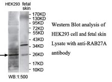 RAB27A / RAB27 Antibody