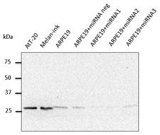 RAB27A / RAB27 Antibody - Western blot. Anti-Rab27 antibody at 1:500 dilution. Rabbit polyclonal to goat IgG (HRP) at 1:10000 dilution.