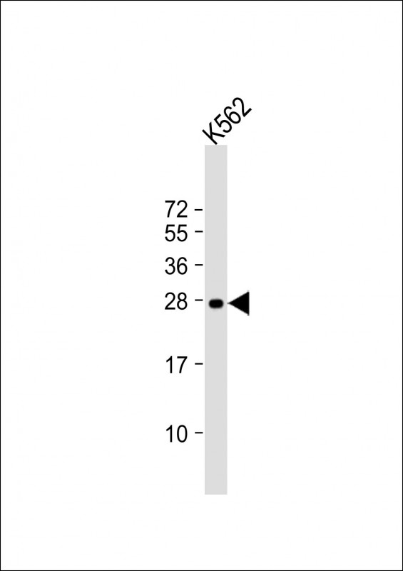 RAB27A / RAB27 Antibody - Anti-RAB27A Antibody at 1:2000 dilution + K562 whole cell lysate Lysates/proteins at 20 ug per lane. Secondary Goat Anti-mouse IgG, (H+L), Peroxidase conjugated at 1:10000 dilution. Predicted band size: 25 kDa. Blocking/Dilution buffer: 5% NFDM/TBST.