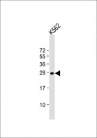 RAB27A / RAB27 Antibody - Anti-RAB27A Antibody at 1:2000 dilution + K562 whole cell lysate Lysates/proteins at 20 ug per lane. Secondary Goat Anti-mouse IgG, (H+L), Peroxidase conjugated at 1:10000 dilution. Predicted band size: 25 kDa. Blocking/Dilution buffer: 5% NFDM/TBST.