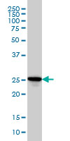 RAB27A / RAB27 Antibody - RAB27A monoclonal antibody (M02), clone 1G7 Western blot of RAB27A expression in HL-60.
