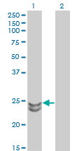 RAB27A / RAB27 Antibody - Western blot of RAB27A expression in transfected 293T cell line by RAB27A monoclonal antibody (M02), clone 1G7.