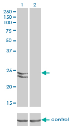 RAB27A / RAB27 Antibody - Western blot of RAB27A over-expressed 293 cell line, cotransfected with RAB27A Validated Chimera RNAi (Lane 2) or non-transfected control (Lane 1). Blot probed with RAB27A monoclonal antibody, clone 1G7. GAPDH ( 36.1 kD ) used as specific.