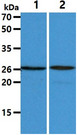 RAB27A / RAB27 Antibody - The Cell lysates (40ug) were resolved by SDS-PAGE, transferred to PVDF membrane and probed with anti-human RAB27A antibody (1:1000). Proteins were visualized using a goat anti-mouse secondary antibody conjugated to HRP and an ECL detection system. Lane 1. : THP-1 cell lysate Lane 2. : A549 cell lysate