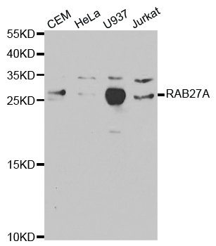 RAB27A / RAB27 Antibody - Western blot analysis of extracts of various cell lines.