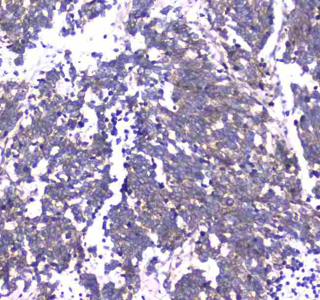 RAB27A / RAB27 Antibody - Immunohistochemistry - Anti-RAB27A Picoband antibody