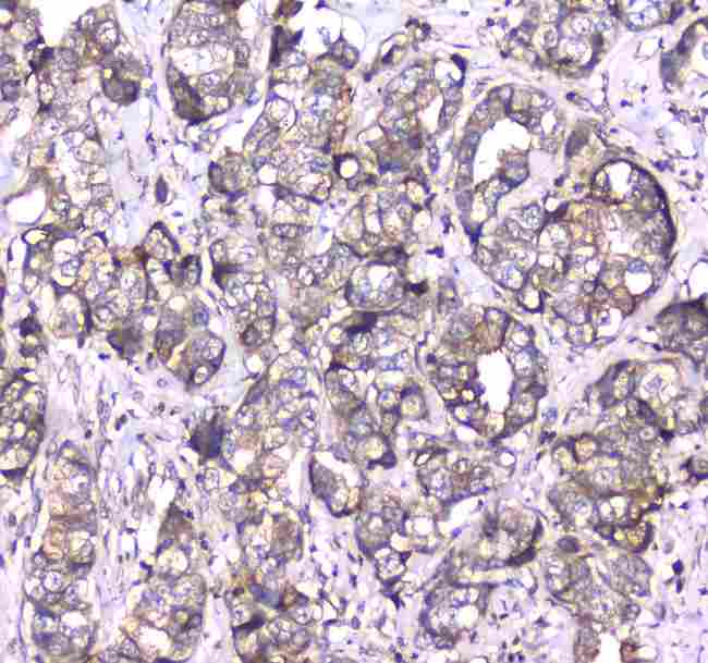 RAB27A / RAB27 Antibody - Immunohistochemistry - Anti-RAB27A Picoband antibody