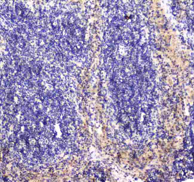 RAB27A / RAB27 Antibody - Immunohistochemistry - Anti-RAB27A Picoband antibody