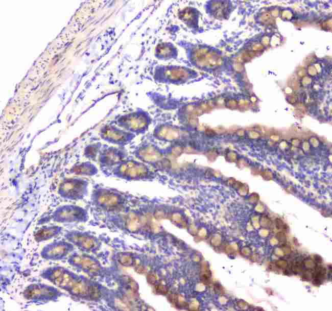 RAB27A / RAB27 Antibody - Immunohistochemistry - Anti-RAB27A Picoband antibody