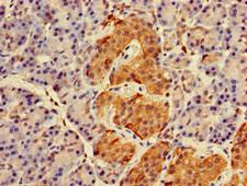 RAB27A / RAB27 Antibody - Immunohistochemistry of paraffin-embedded human pancreatic tissue at dilution of 1:100