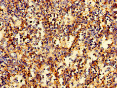 RAB27A / RAB27 Antibody - Immunohistochemistry of paraffin-embedded human spleen tissue at dilution of 1:100