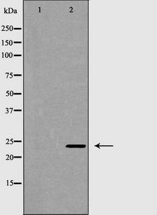 RAB27A / RAB27 Antibody - Western blot analysis of K562 cell lysates using RAB27A antibody. The lane on the left is treated with the antigen-specific peptide.