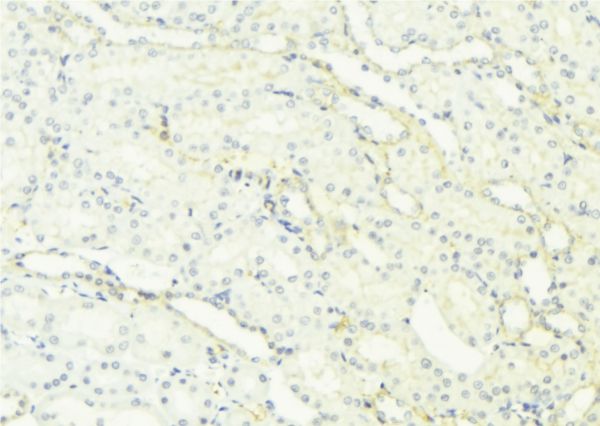 RAB27A / RAB27 Antibody - 1:100 staining mouse kidney tissue by IHC-P. The sample was formaldehyde fixed and a heat mediated antigen retrieval step in citrate buffer was performed. The sample was then blocked and incubated with the antibody for 1.5 hours at 22°C. An HRP conjugated goat anti-rabbit antibody was used as the secondary.
