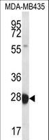 RAB27B Antibody - RAB27B Antibody western blot of MDA-MB435 cell line lysates (35 ug/lane). The RAB27B antibody detected the RAB27B protein (arrow).