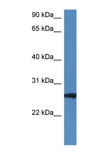 RAB27B Antibody - RAB27B antibody Western blot of Mouse Heart lysate. Antibody concentration 1 ug/ml.  This image was taken for the unconjugated form of this product. Other forms have not been tested.