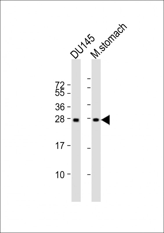 RAB27B Antibody - All lanes: Anti-RAB27B Antibody at 1:2000 dilution. Lane 1: DU145 whole cell lysate. Lane 2: mouse stomach lysate Lysates/proteins at 20 ug per lane. Secondary Goat Anti-mouse IgG, (H+L), Peroxidase conjugated at 1:10000 dilution. Predicted band size: 25 kDa. Blocking/Dilution buffer: 5% NFDM/TBST.