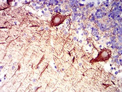 RAB27B Antibody - Immunohistochemical analysis of paraffin-embedded cerebellum tissues using RAB27B mouse mAb with DAB staining.