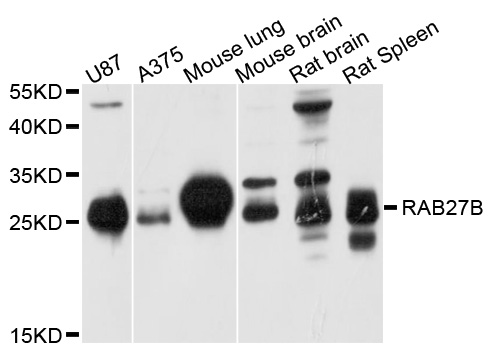 RAB27B Antibody - Western blot analysis of extracts of various cell lines, using RAB27B antibody at 1:1000 dilution. The secondary antibody used was an HRP Goat Anti-Rabbit IgG (H+L) at 1:10000 dilution. Lysates were loaded 25ug per lane and 3% nonfat dry milk in TBST was used for blocking. An ECL Kit was used for detection and the exposure time was 10s.
