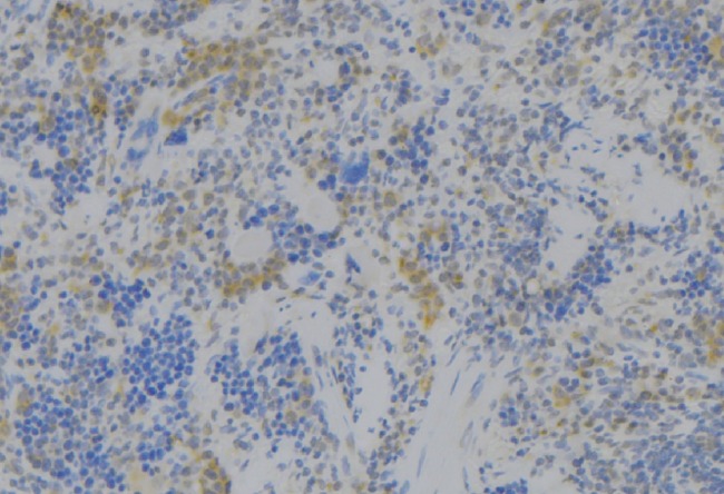 RAB27B Antibody - 1:100 staining human lymph node tissue by IHC-P. The sample was formaldehyde fixed and a heat mediated antigen retrieval step in citrate buffer was performed. The sample was then blocked and incubated with the antibody for 1.5 hours at 22°C. An HRP conjugated goat anti-rabbit antibody was used as the secondary.
