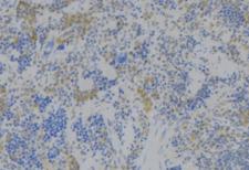 RAB27B Antibody - 1:100 staining human lymph node tissue by IHC-P. The sample was formaldehyde fixed and a heat mediated antigen retrieval step in citrate buffer was performed. The sample was then blocked and incubated with the antibody for 1.5 hours at 22°C. An HRP conjugated goat anti-rabbit antibody was used as the secondary.