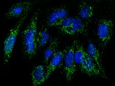 RAB27B Antibody - Immunofluorescence staining of His-RAB27B in U251MG cells. Cells were fixed with 4% PFA, permeabilzed with 0.3% Triton X-100 in PBS, blocked with 10% serum, and incubated with rabbit anti-Human His-RAB27B polyclonal antibody (dilution ratio 1:1000) at 4°C overnight. Then cells were stained with the Alexa Fluor 488-conjugated Goat Anti-rabbit IgG secondary antibody (green) and counterstained with DAPI (blue). Positive staining was localized to cytoplasm.