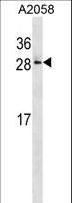 RAB28 Antibody - RAB28 Antibody western blot of A2058 cell line lysates (35 ug/lane). The RAB28 antibody detected the RAB28 protein (arrow).