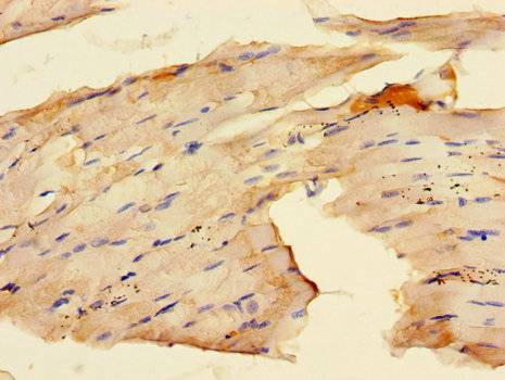 RAB28 Antibody - Immunohistochemistry of paraffin-embedded human skeletal muscle tissue using RAB28 Antibody at dilution of 1:100