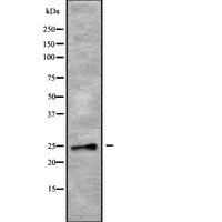 RAB28 Antibody - Western blot analysis of RAB28 using COLO205 whole cells lysates