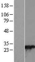 RAB28 Protein - Western validation with an anti-DDK antibody * L: Control HEK293 lysate R: Over-expression lysate