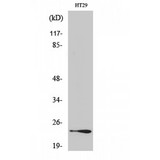 RAB29 / RAB7L1 Antibody - Western blot of Rab 7L1 antibody