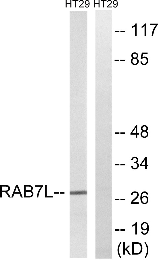 RAB29 / RAB7L1 Antibody - Western blot analysis of lysates from HT-29 cells, using RAB7L1 Antibody. The lane on the right is blocked with the synthesized peptide.
