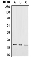 RAB29 / RAB7L1 Antibody - Western blot analysis of RAB7L1 expression in HEK293T (A); SP2/0 (B); PC12 (C) whole cell lysates.