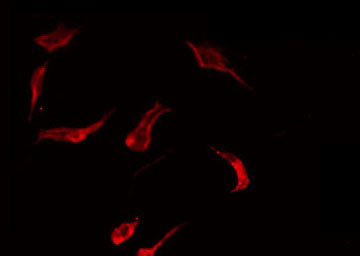 RAB29 / RAB7L1 Antibody - Staining HT29 cells by IF/ICC. The samples were fixed with PFA and permeabilized in 0.1% Triton X-100, then blocked in 10% serum for 45 min at 25°C. The primary antibody was diluted at 1:200 and incubated with the sample for 1 hour at 37°C. An Alexa Fluor 594 conjugated goat anti-rabbit IgG (H+L) Ab, diluted at 1/600, was used as the secondary antibody.