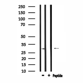 RAB29 / RAB7L1 Antibody - Western blot analysis of extracts of mouse brain tissue using RAB7L1 antibody.