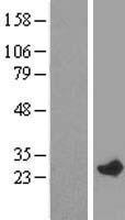 RAB29 / RAB7L1 Protein - Western validation with an anti-DDK antibody * L: Control HEK293 lysate R: Over-expression lysate