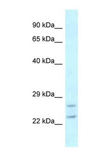 RAB2A / RAB2 Antibody - RAB2A / RAB2 antibody western blot of MDA-MB435S cell lysate. Antibody concentration 1 ug/ml.  This image was taken for the unconjugated form of this product. Other forms have not been tested.