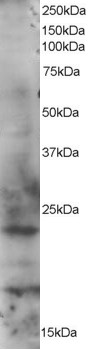 RAB2A / RAB2 Antibody - Antibody staining (1 ug/ml) of HeLa lysate (RIPA buffer, 35 ug total protein per lane). Primary incubated for 1 hour. Detected by Western blot of chemiluminescence.