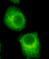 RAB2A / RAB2 Antibody - Immunocytochemistry of HeLa cells using anti- RAB2A(C-Terminus) antibody diluted 1:200.