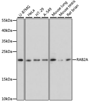 RAB2A / RAB2 Antibody - Western blot analysis of extracts of various cell lines, using RAB2A antibody at 1:3000 dilution. The secondary antibody used was an HRP Goat Anti-Rabbit IgG (H+L) at 1:10000 dilution. Lysates were loaded 25ug per lane and 3% nonfat dry milk in TBST was used for blocking. An ECL Kit was used for detection and the exposure time was 60s.