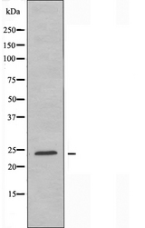 RAB2A / RAB2 Antibody - Western blot analysis of extracts of A549 cells using RAB2A antibody.