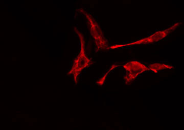 RAB2A / RAB2 Antibody - Staining A549 cells by IF/ICC. The samples were fixed with PFA and permeabilized in 0.1% Triton X-100, then blocked in 10% serum for 45 min at 25°C. The primary antibody was diluted at 1:200 and incubated with the sample for 1 hour at 37°C. An Alexa Fluor 594 conjugated goat anti-rabbit IgG (H+L) antibody, diluted at 1/600, was used as secondary antibody.