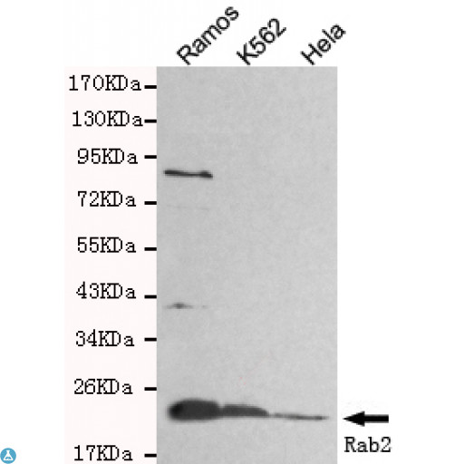 RAB2A / RAB2 Antibody - Western blot detection of Rab2 in Hela, Ramos and K562 cell lysates and using Rab2 mouse mAb (1:800 diluted). Predicted band size: 24KDa. Observed band size: 24KDa.