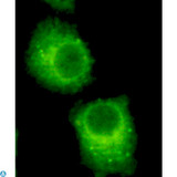 RAB2A / RAB2 Antibody - Immunocytochemistry of HeLa cells using anti-Rab2 mouse mAb diluted 1:200.