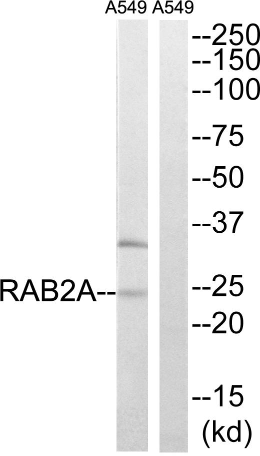 RAB2A / RAB2 Antibody - Western blot analysis of extracts from A549 cells, using RAB2A antibody.